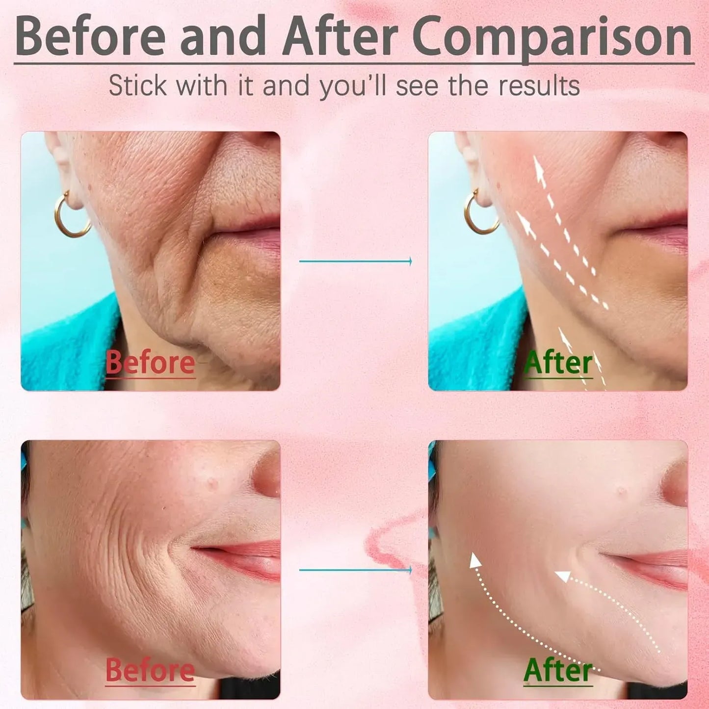 Face & Neck Massager – Skin Tightening & Anti-Aging Therapy